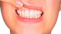 Periodoncia en AB Dental