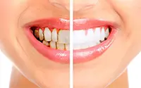 Rehabilitación oral en clínica dental